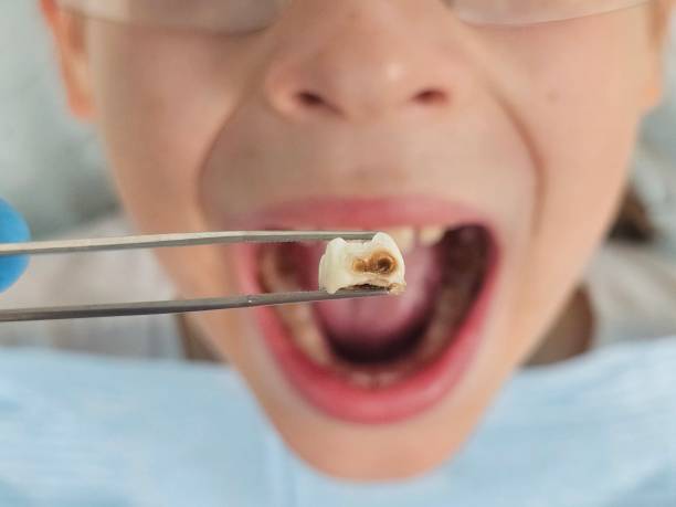 Best Emergency Dentist for Special Needs Patients in Coal City, IL